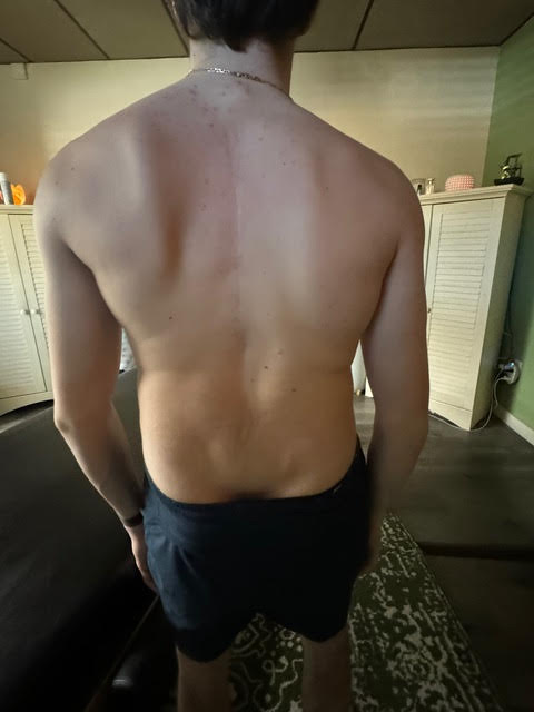 Before & After Results - Image 1